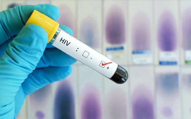 Vacuna contra el HIV: reacciones positivas y esperanza