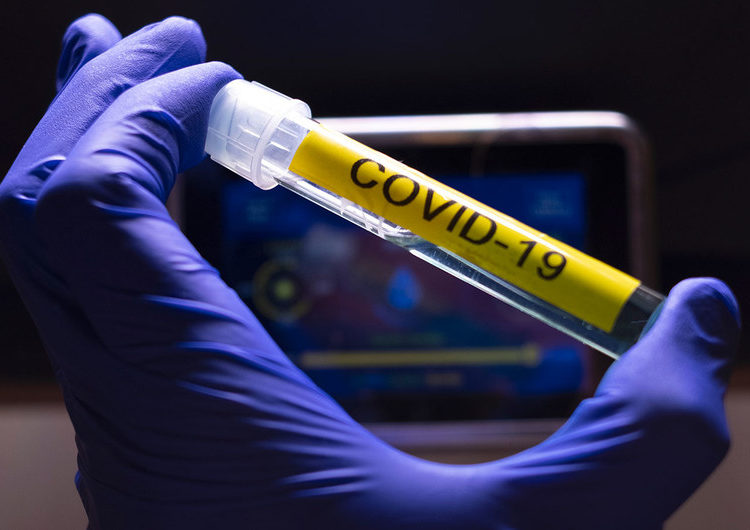 Analisis de la pandemia: lo que todos deben saber