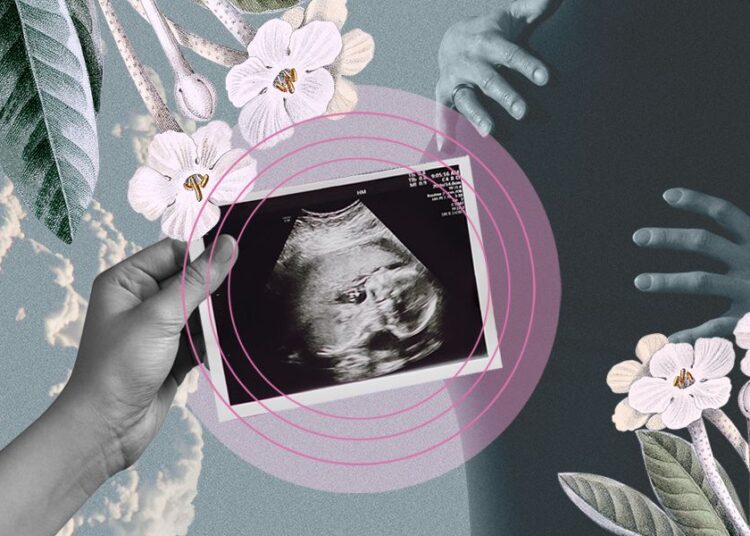 Collage: Sofía Valenzuela