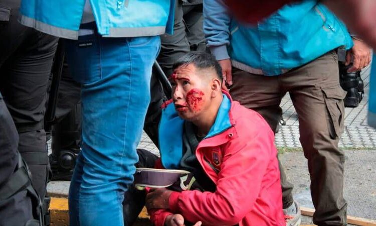 “Made in EEUU”: El Modelo represivo de palos y motosierra importado por el gobierno argentino